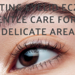Treating Eyelid Eczema: Gentle Care for a Delicate Area