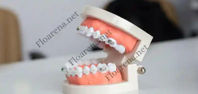 Benefits of Proper Teeth Alignment Treatment
